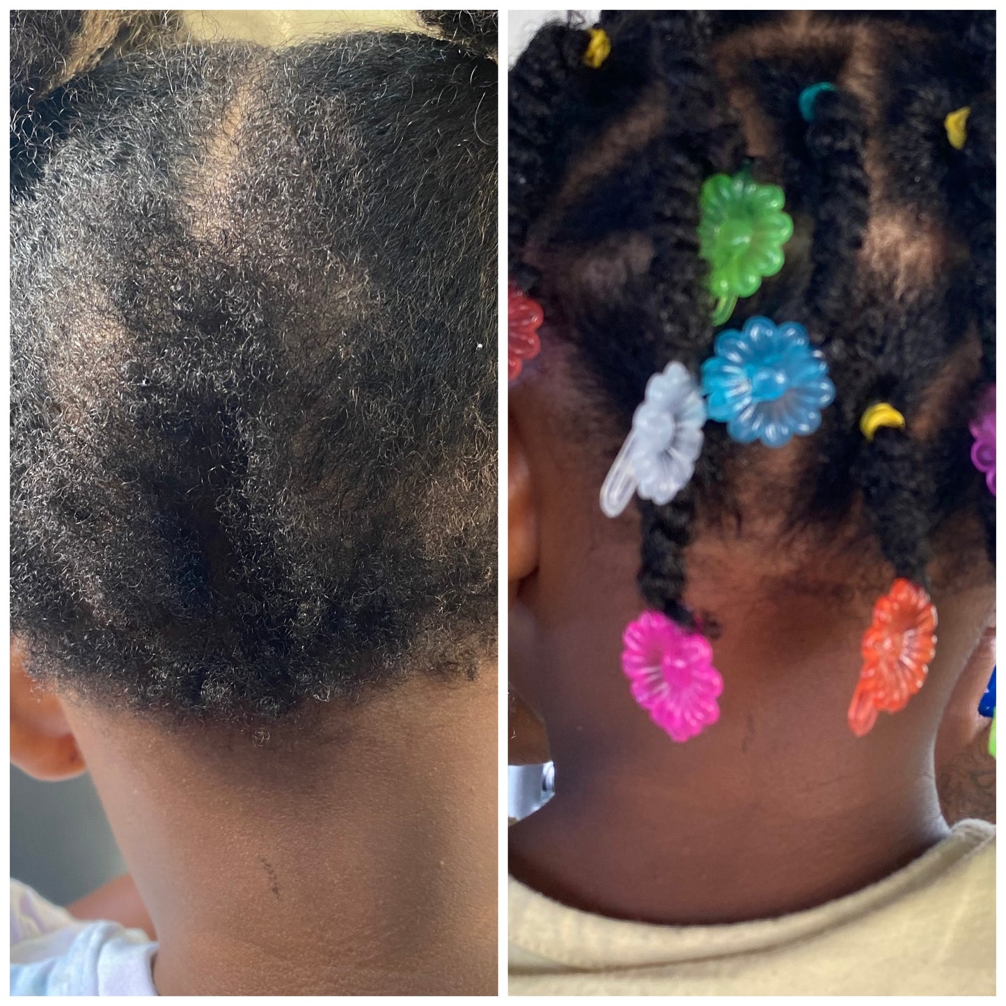 Full Crown Restoration Kit - Hair & Skin Revival by Siri Ya Malkia