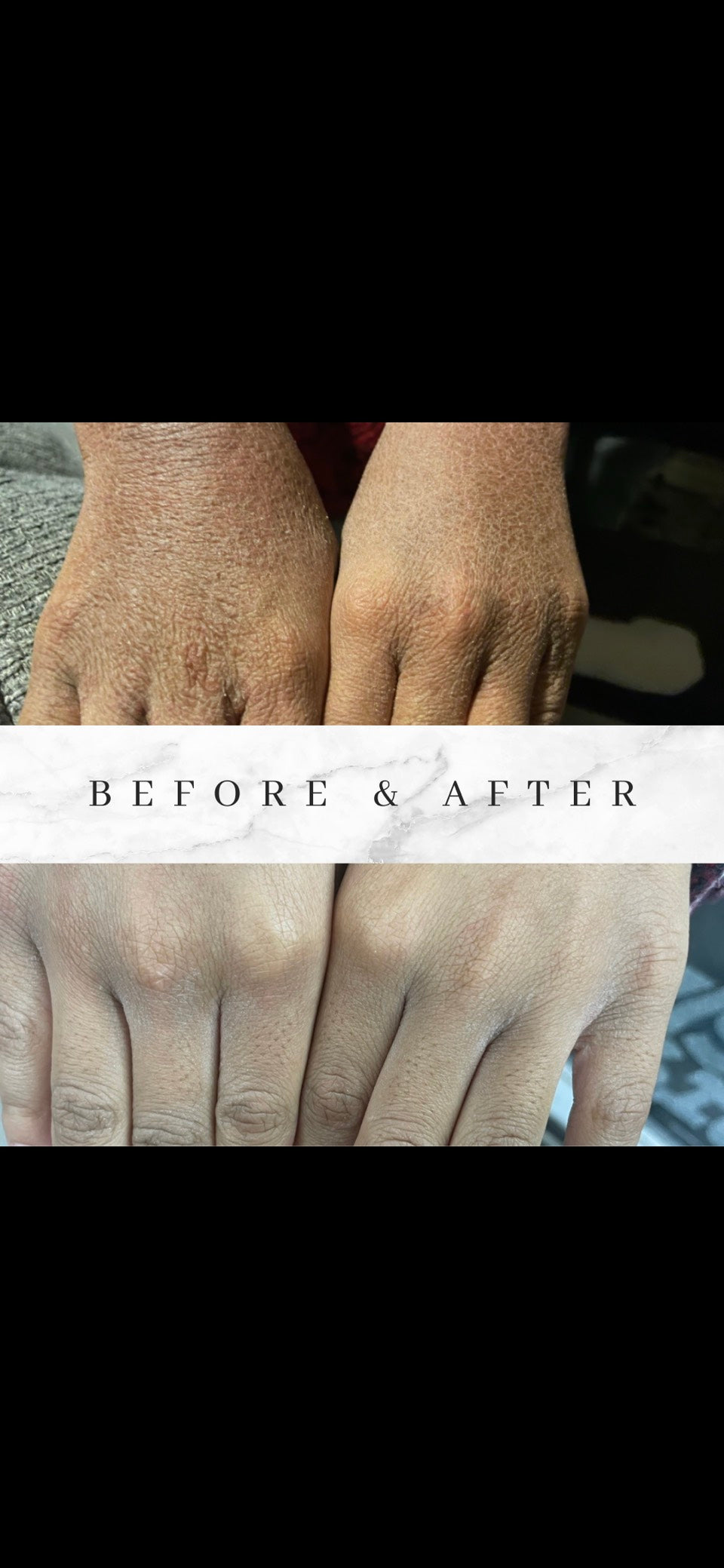 Rose Infused Skin Repair Serum