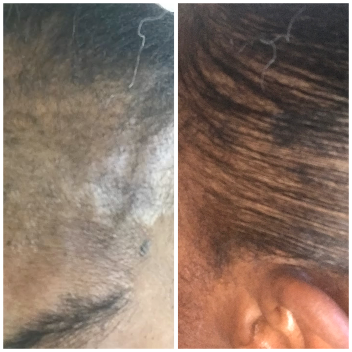 Full Crown Restoration Kit - Hair & Skin Revival by Siri Ya Malkia