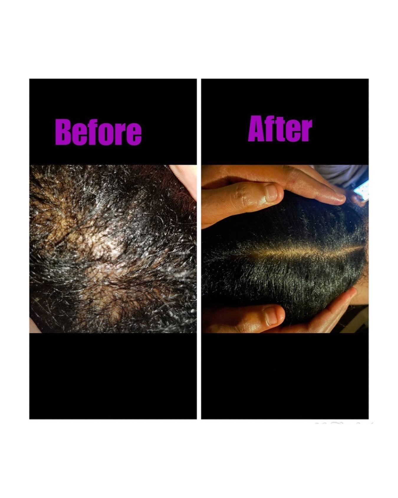 Hair Loss Formula
