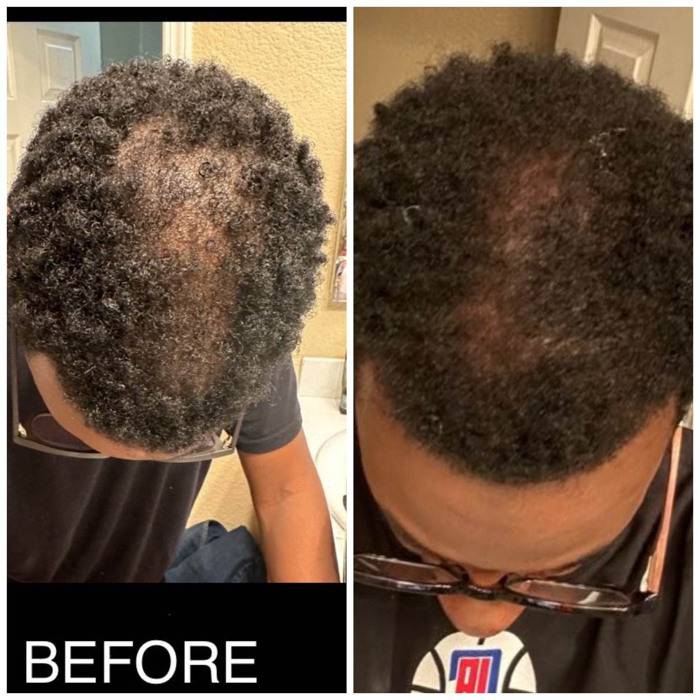 Hair Loss Formula