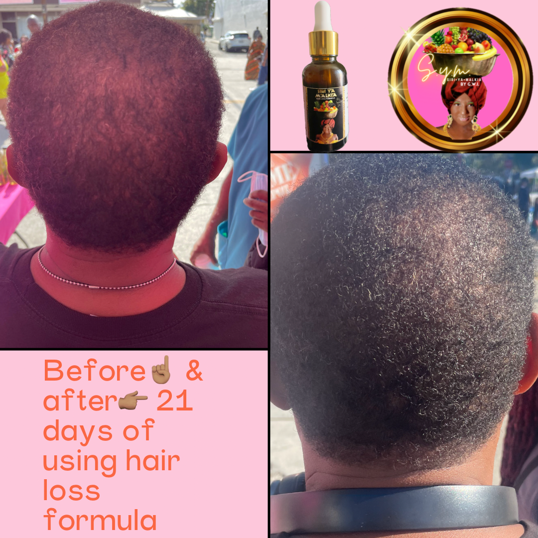 Hair Loss Formula